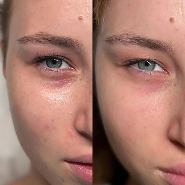 EYE BOOSTER